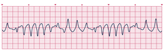 <p>identify the rhythm</p>