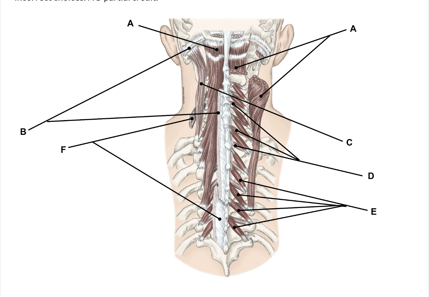 <p><span>Match the appropriate term with the landmark or structure (A-F) identified in the picture below. The muscle marked as A is labeled on both sides for clarity. Answers are used once and there are incorrect choices. NO partial credit.</span></p>