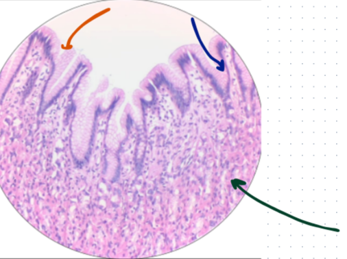 <p>What is this histology slide? What is the orange arrow? What is the blue arrow? What is the green arrow?</p>