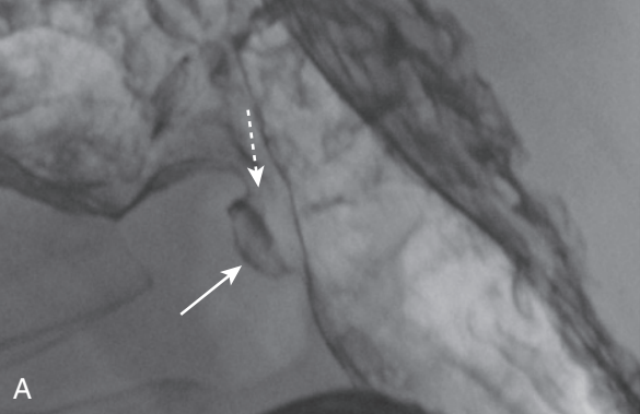 <p>diagnosis</p>