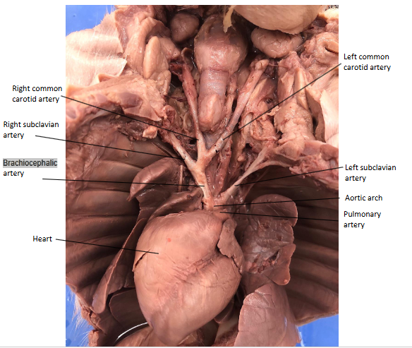 <p>is the first branch of the aortic arch and supplies blood to the brain, right arm, neck. Right subclavian and right and left common carotid artery</p>