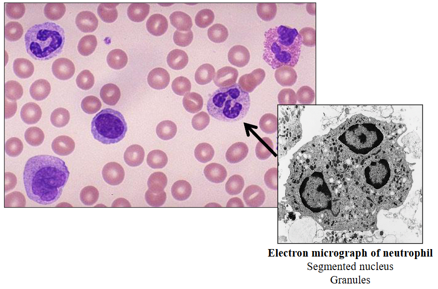 <p>a) Neutrophils</p>