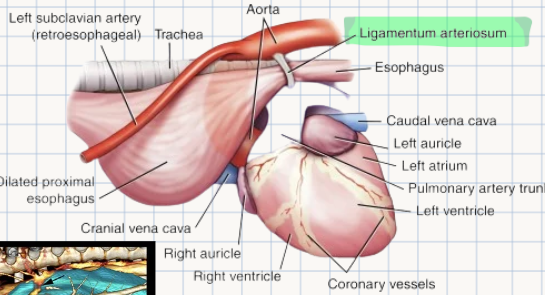 <p>PERSISTENT RIGHT AORTIC ARCH (PRAA)</p><p>Persistent right aortic arch leads to the entrapment and compression of which two non-vascular anatomical structures?</p>