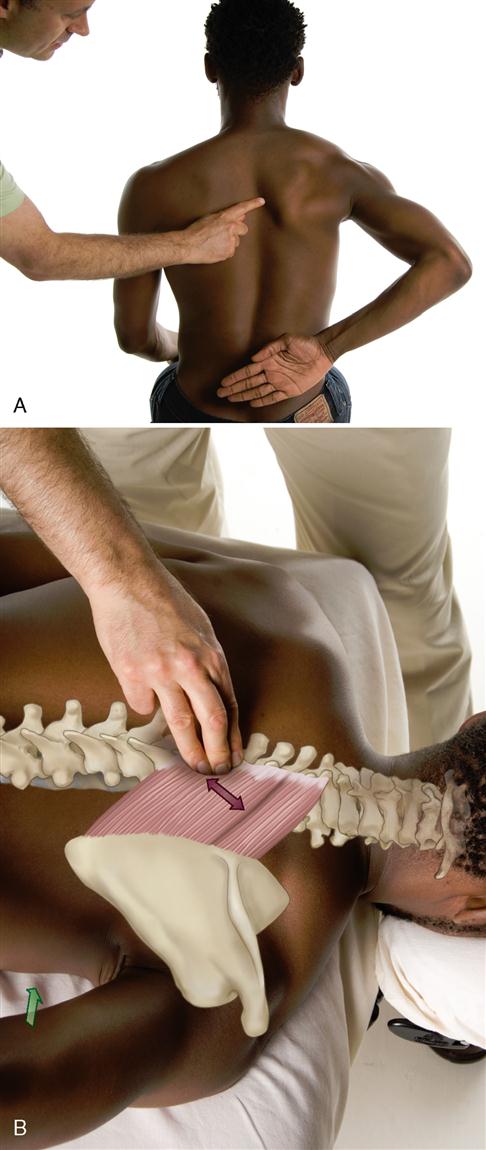 <p><strong>Location</strong>: Under trapezius, between scapula and spine.</p><p></p><p>Confirm: Resisted scapular retraction with hand behind back.</p>