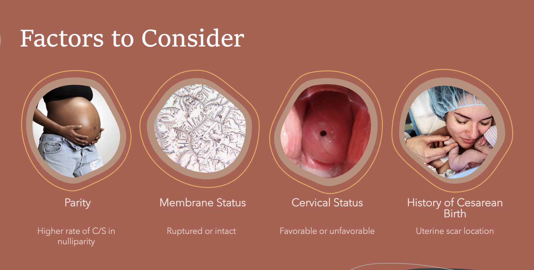 <p>Factors to Consider</p>