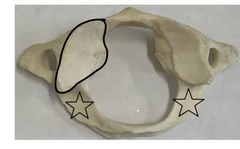 <p>what is marked? (not the star)</p>
