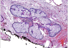 <p>This is a histological section of what?</p>