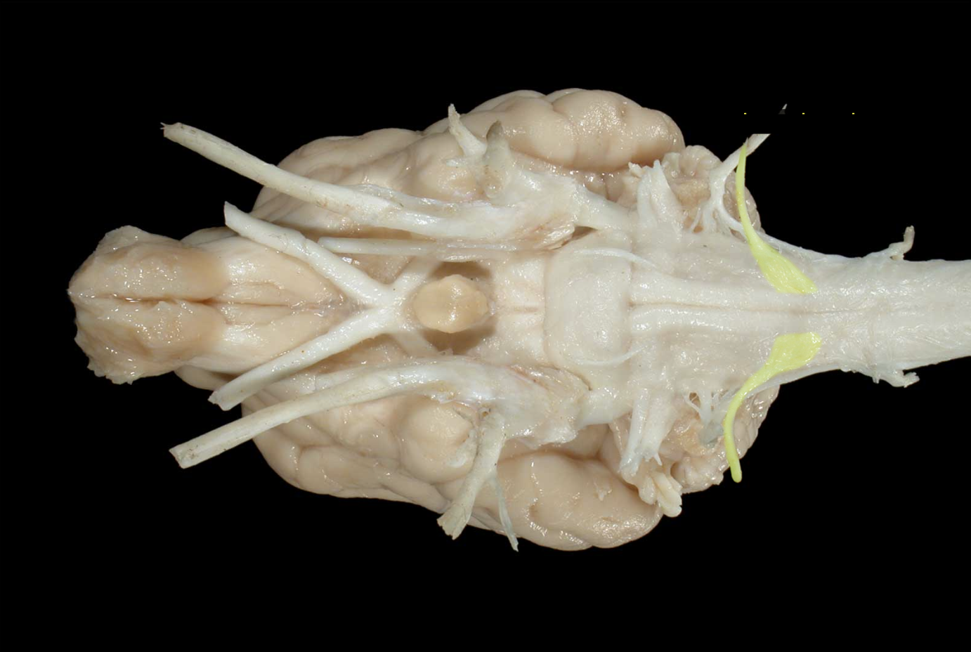 <p>what nerve is this</p>