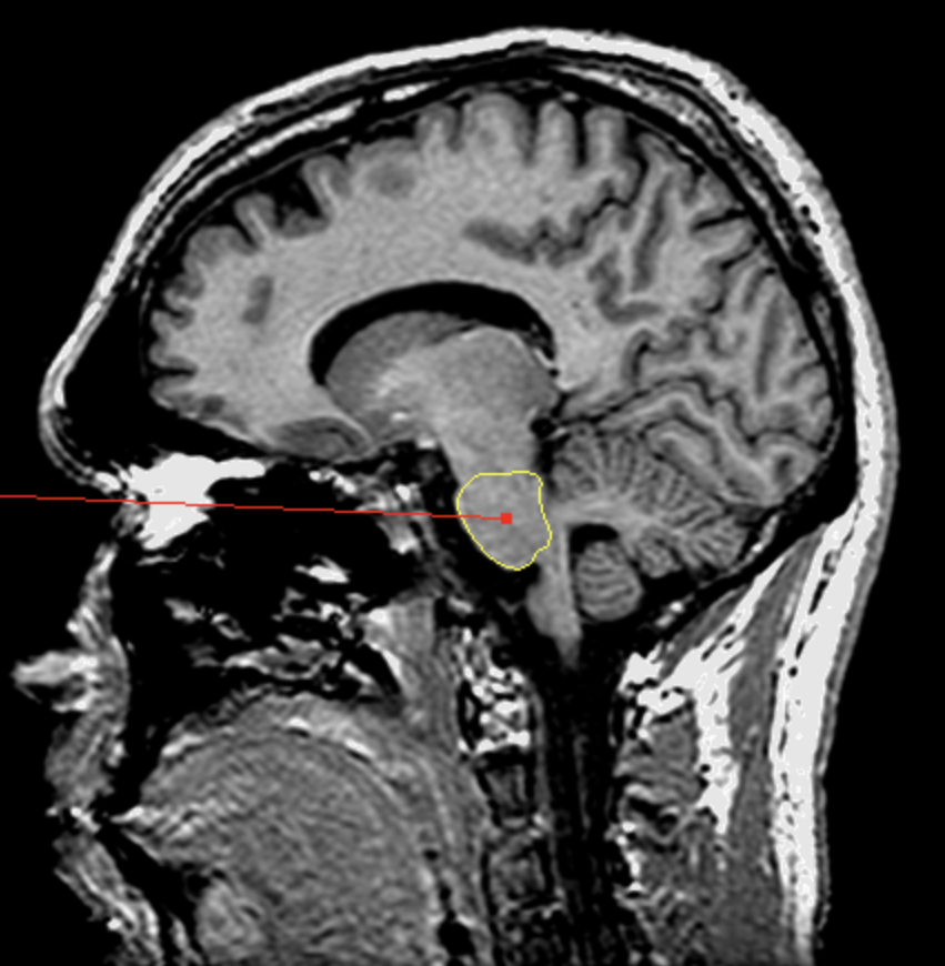 <p>What is the area highlighted called?</p>