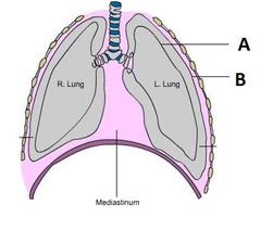 <p>A</p>