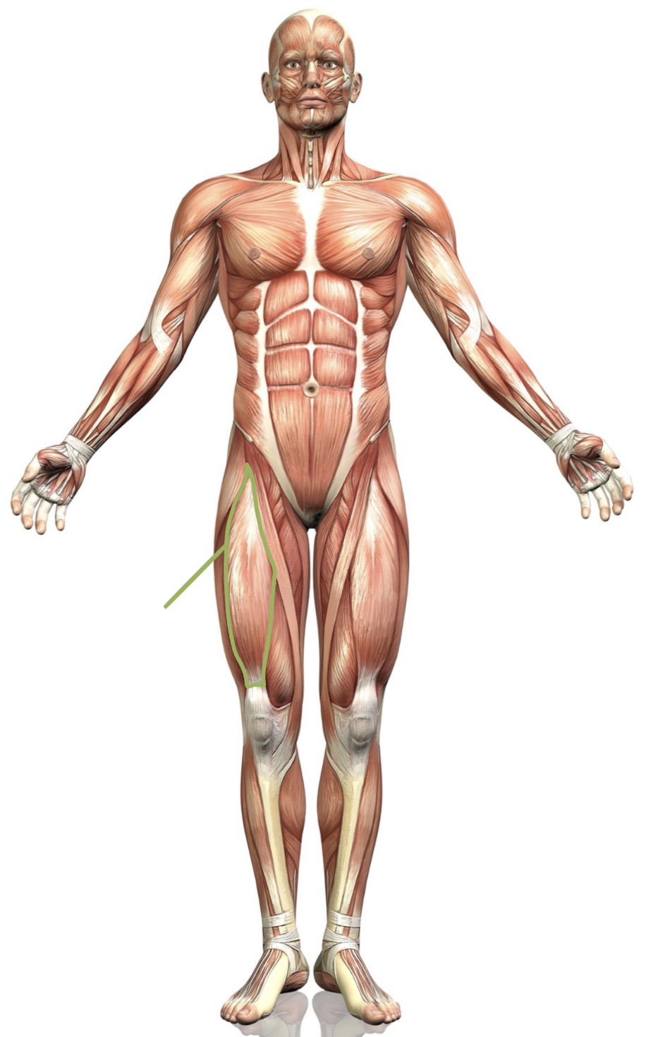 <p><strong>Name the following muscle</strong></p>