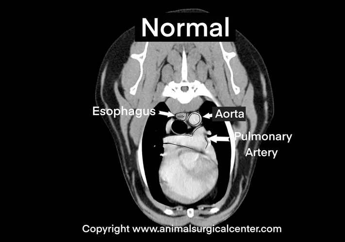 <p>Normal Aortic Development</p>