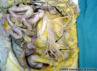 <p>which arteries are pictured (context, loops of the small intestine have been removed)?</p>