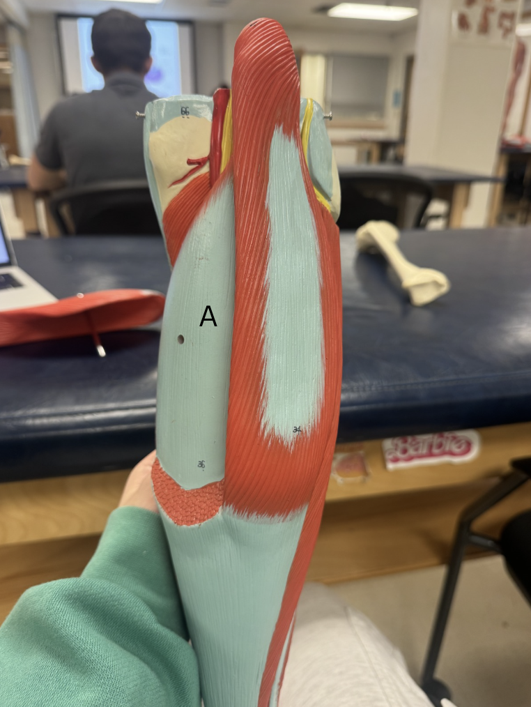 <p>Label this muscle</p>