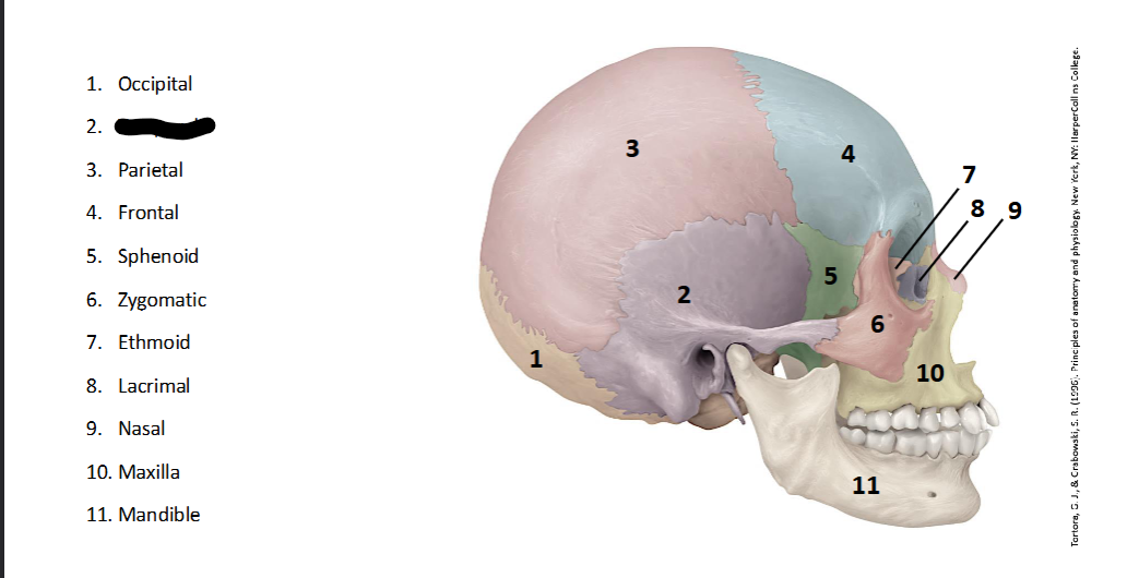 <p>What landmark within the <strong>Skull? (LATERAL)</strong></p>