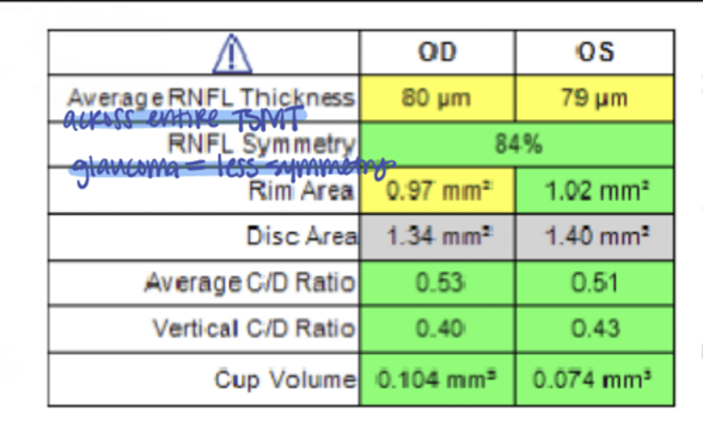 <p>In glaucoma, there will be a (higher/lower) symmetry value</p>