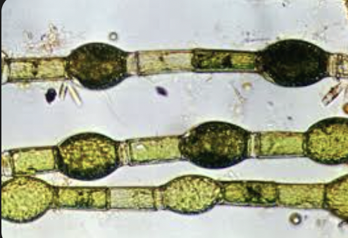 <ul><li><p><mark data-color="rgba(0, 0, 0, 0)" style="background-color: rgba(0, 0, 0, 0); color: inherit;">filamentous</mark></p></li><li><p><mark data-color="rgba(0, 0, 0, 0)" style="background-color: rgba(0, 0, 0, 0); color: inherit;">unbranched green alga characterized by cylindrical cells</mark></p></li><li><p><mark data-color="rgba(0, 0, 0, 0)" style="background-color: rgba(0, 0, 0, 0); color: inherit;">a specialized holdfast for attachment</mark></p></li><li><p><mark data-color="rgba(0, 0, 0, 0)" style="background-color: rgba(0, 0, 0, 0); color: inherit;">unique ring-like apical caps resulting from cell division</mark></p></li><li><p><span>net-like chloroplast</span></p></li><li><p><span>thick cell walls (cellulose/chitin)</span></p></li><li><p><span>reproduces via zoospores or oogamy</span></p></li></ul><p></p>