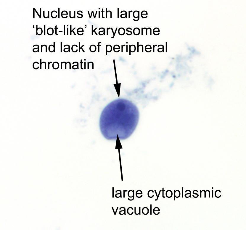 <p>Trophozoite has a large karyosome</p><p>Cyst has a large vacuole that stains with iodine, also large “blot-like” karyosome</p>