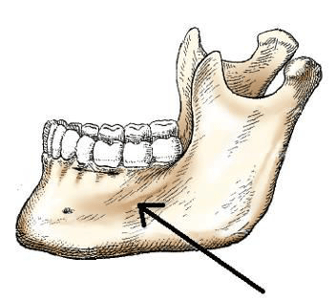 <p>The part of the mandible identified in the figure below is the:</p><p>a. body.</p><p>b. ramus.</p><p>c. symphysis.</p><p>d. alveolar portion</p>