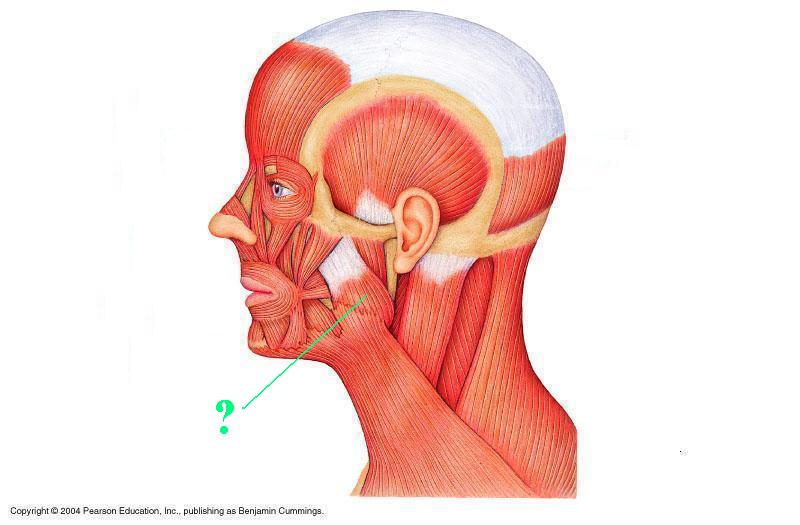 <p>Identify the indicated muscle</p>