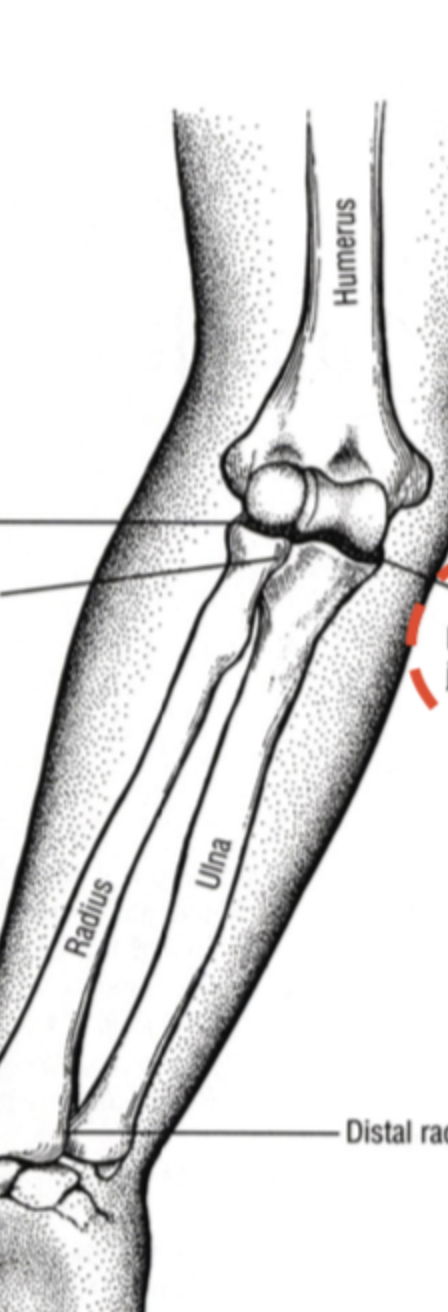 <p><span>Humeroulnar Joint; DOF, Planes, Type</span></p>