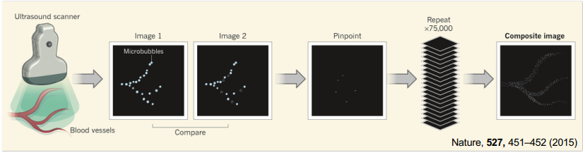 <ol><li><p>contrast agent is injected → usually microbubbles</p></li><li><p>if you can image a single microbubble and know it is just one → positional accuracy can be determined more accurately  </p></li><li><p>allows us to replace the blurry image with a single sharp point </p></li></ol><p></p><p>used in vascular imaging to image very small vessels </p><p></p>