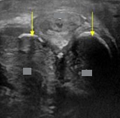 <p>Identify this image. </p>