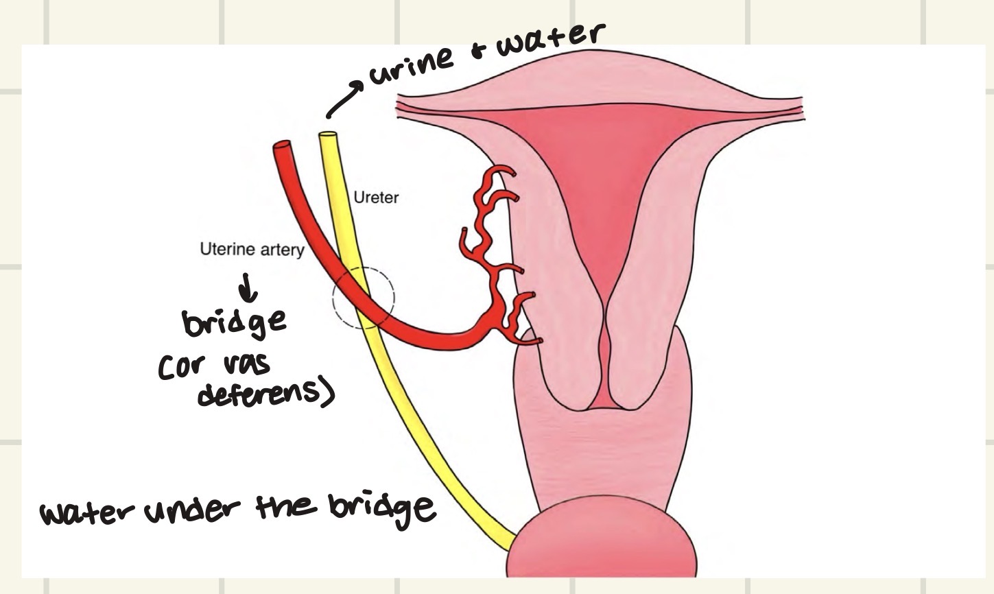 <p>Answer: The ureter passes under the vas deferens or uterine artery.</p>
<p>Extra Information:</p>
<ul>
<li>“Water” represents the ureter.</li>
<li>The slide uses this phrase to remember the anatomical relationship.</li>
</ul>