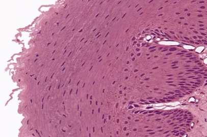 <p>Stratified Squamous Epithelium</p>