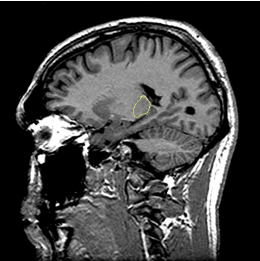 <p>What is the area highlighted called?</p>