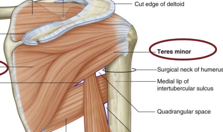<p><span style="background-color: transparent;"><strong>Rotator Cuff Muscle: </strong>Tres<strong> </strong>minor</span></p>