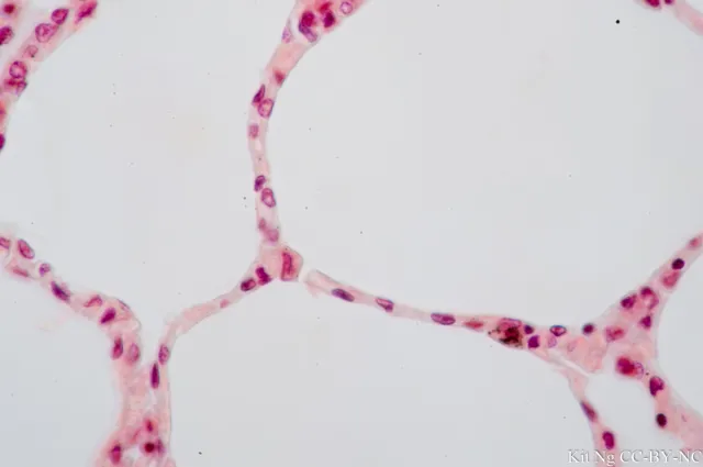 <p>Picture from lung alveoli</p>