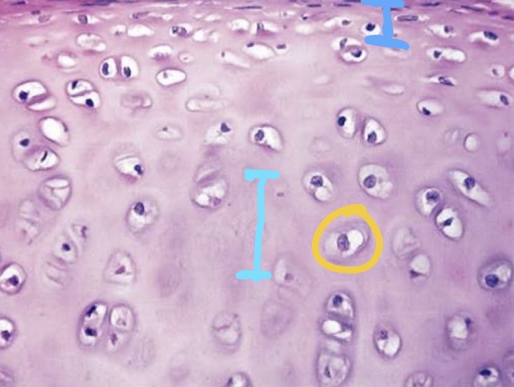 <p>what is the yellow highlighted structure in hyaline cartilage </p>