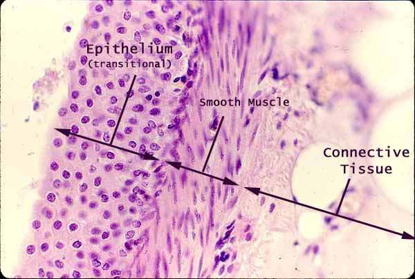 <p>Epithelial tissue and connective tissue.</p>