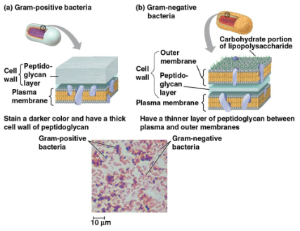 <p>Gram stain</p>