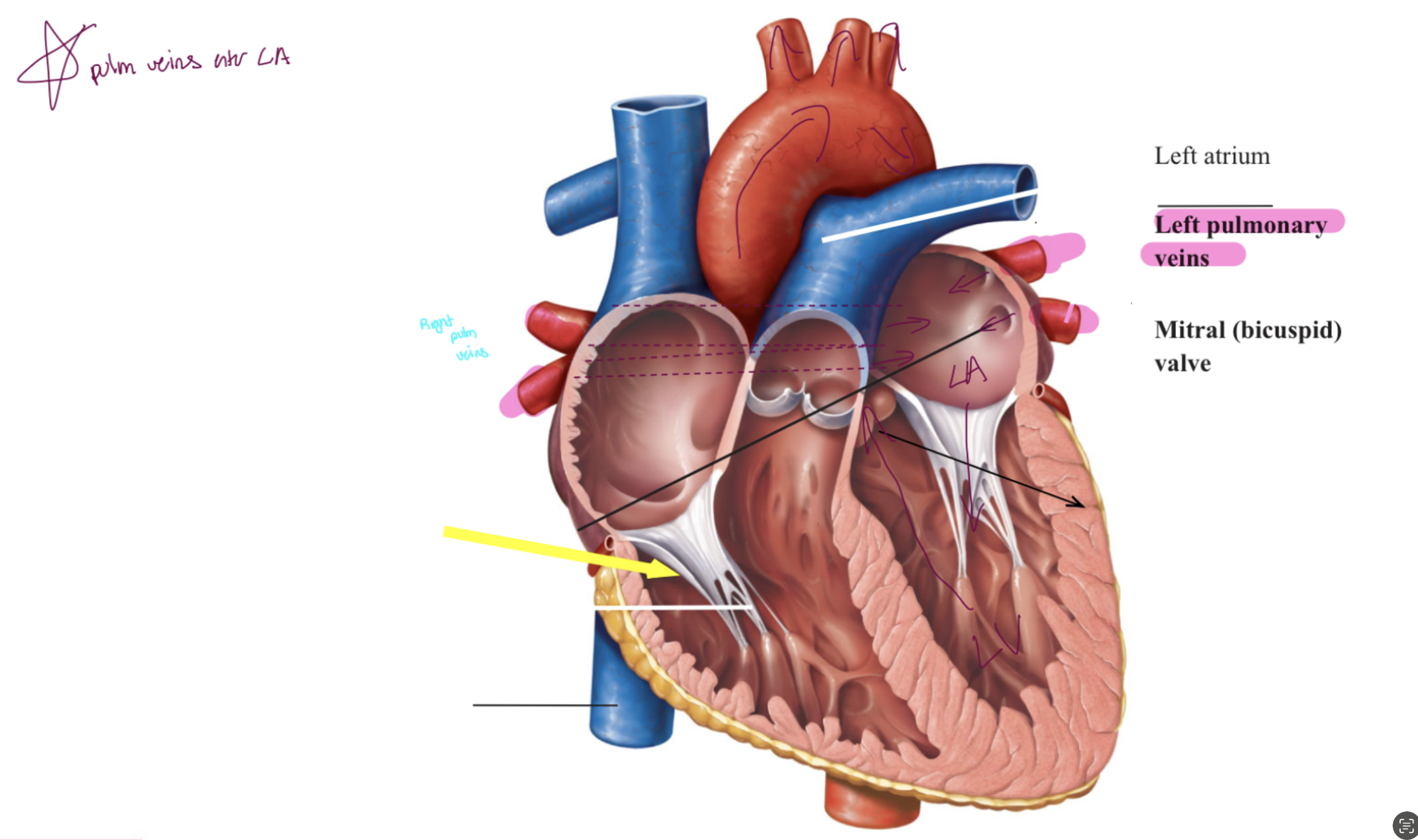 <ul><li><p><span>The <strong>pulmonary veins</strong> bring the <strong>now-oxygenated blood</strong> to the <strong>left<br>atrium</strong></span></p></li><li><p><span>The left atrium also has an <strong>auricle</strong></span></p></li><li><p><span>The blood flows <strong>anterio-inferiorly</strong> to the ventricle via the<br><strong>atrioventricular opening</strong> when the AV valve <strong>opens</strong></span></p></li></ul><p></p><p><span>*** left AV valve =  bicuspid valve = mitral valve ****<br></span></p><p></p>