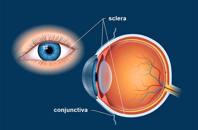 <p>Sclera</p>
