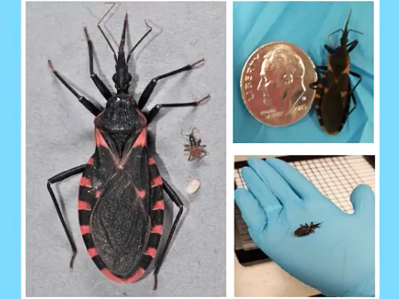 <p>History: A 35-year-old returns from a trip to rural South America with fever, fatigue, and swelling at the site of an insect bite.</p><p>Symptoms: Localized swelling (Romaña's sign), fever, and enlarged lymph nodes.</p><p>Microbiological Clues: Positive serology for Trypanosoma cruzi; parasite observed in blood smear.</p><p>Differential Diagnosis:</p>