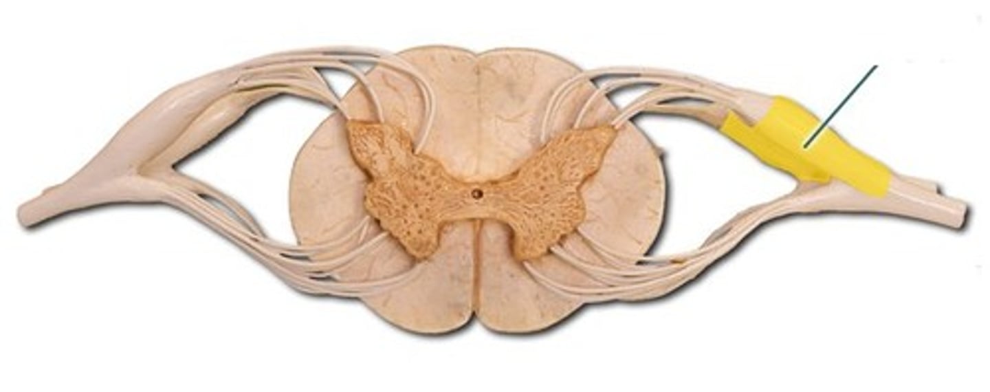 <p>A cluster of sensory neuron cell bodies located on the dorsal root.</p>