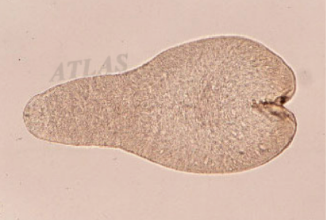 <p><em>Cyathocotyle </em>spp</p>