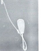 <p>What is this? Normal or abnormal sperm?</p>