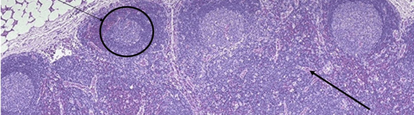 <p>What is the encircled area showcasing?</p>