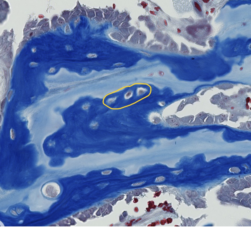 <p>ID the encircled bone cells</p>