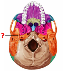 <p>Identify this structure.</p>