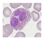<p>- Eosinophilic differentiation (specific granules) at the myelocyte stage</p><p>.</p><p>Morphology:</p><p>- Diameter of 12 - 17 micrometres</p><p>- Cytoplasm packed with large round granules</p><p>- Red-orange with Romanowsky stains</p><p>- Nucleus has 2-segments</p><p>.</p><p>- Circulation time: t1/2 of about 4.5 - 8 hours</p><p>- Survive in tissues for 8 - 12 days</p><p>- 1 - 5% of leucocytes (0.1-0.4 x10^9/L)</p><p>.</p><p>- often described as being like glasses with a nose piece</p>
