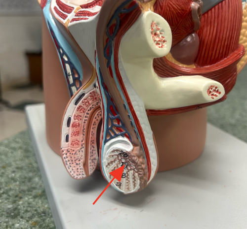 <p>convey sperm from the seminiferous tubules to the epididymis</p>