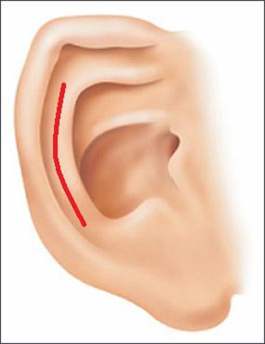 <p>a groove located immediately anterior to the helix, which runs down the posterior portion of the pinna</p>