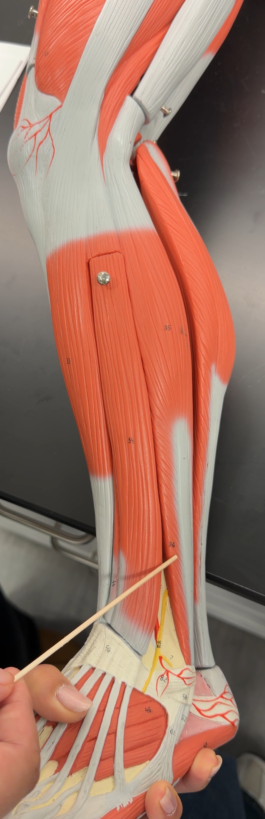 <p>name the muscle and its action</p>
