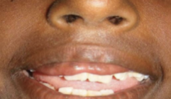 <ol start="26"><li><p>Identify the finding shown.</p></li></ol><p></p>