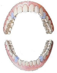 <p>first bicuspids</p>